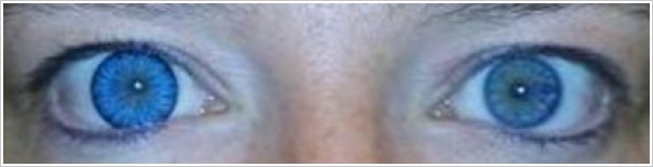 18,63€/1Stk Blau Farbige Big Eye Kontaktlinsen 